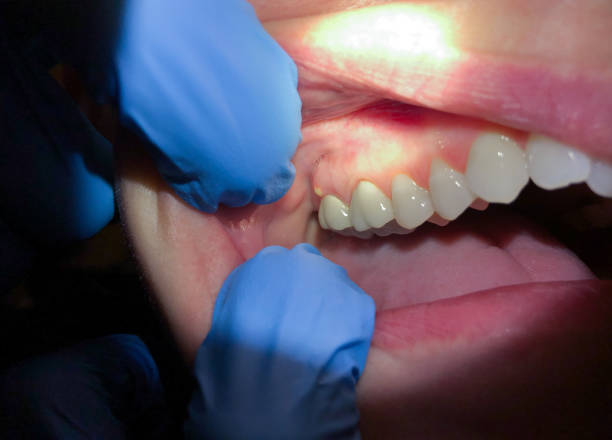 Best Urgent Tooth Repair  in West Jordan, UT