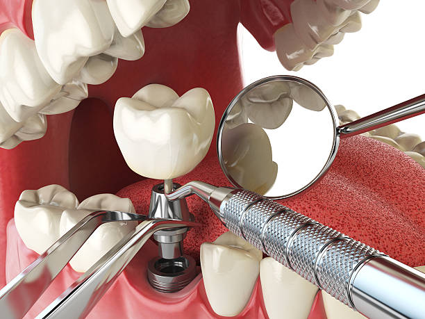 Best Urgent Tooth Repair  in West Jordan, UT